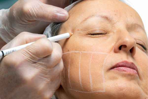 CryoPen: 5 Skin Concerns It May Be Used to Treat 4 What should you ask before having CryoPen treatment West Sussex?